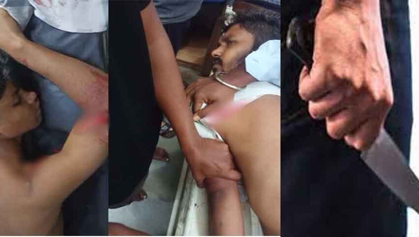  छत्तीसगढ़-दुर्ग में चाकूबाजी और कटरबाजी की घटनाओं में 3 लोग पहुंचे अस्पताल