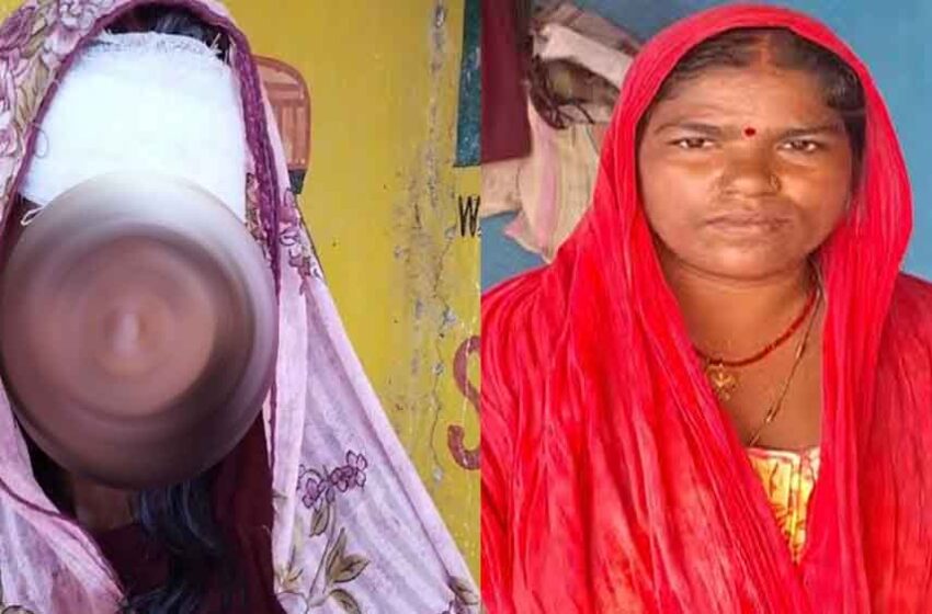  छत्तीसगढ़-बलरामपुर रामानुजगंज में दुर्घटना में महिला का सर फूटने पर लोगों ने मदद कर बचाई जान