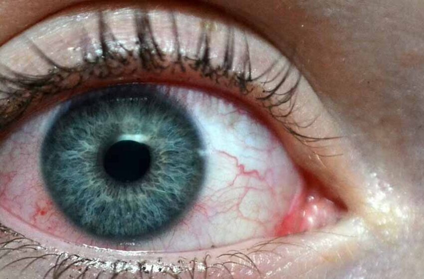  आंखों की जांच: आपकी नजर के साथ कैंसर की शुरुआती चेतावनी भी