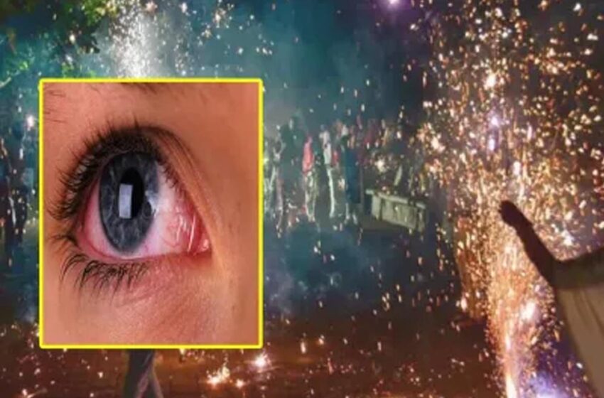  दिवाली से पहले भोपाल में पटाखा गन हादसा: आंख डैमेज, एम्स ने दी सावधानी बरतने की सलाह