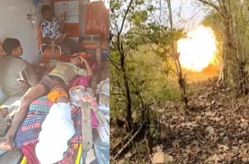  खेलते समय प्रेशर IED पर रखा पैर, ग्रामीण इलाके में मासूम गंभीर घायल